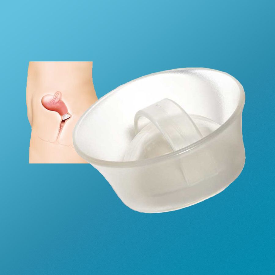 Cervical Cap
