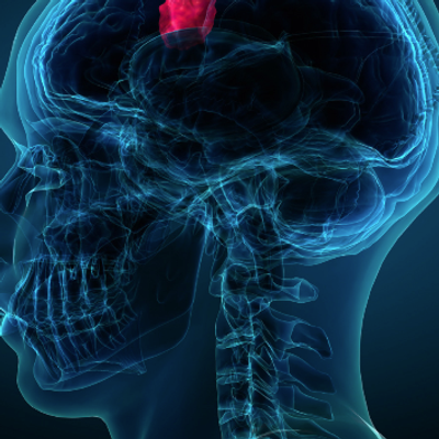 image of head