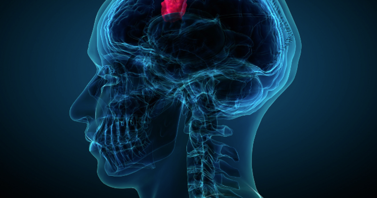 image of head