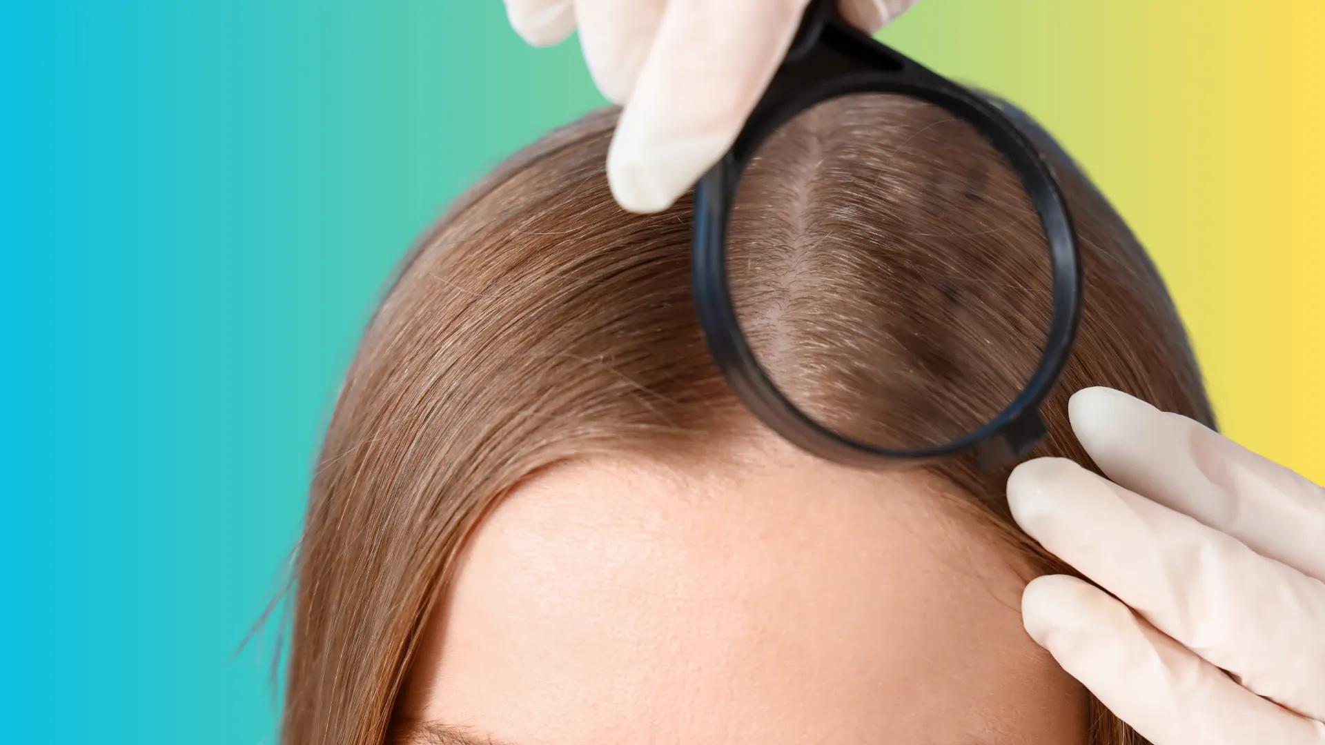 How to Determine Scalp Type