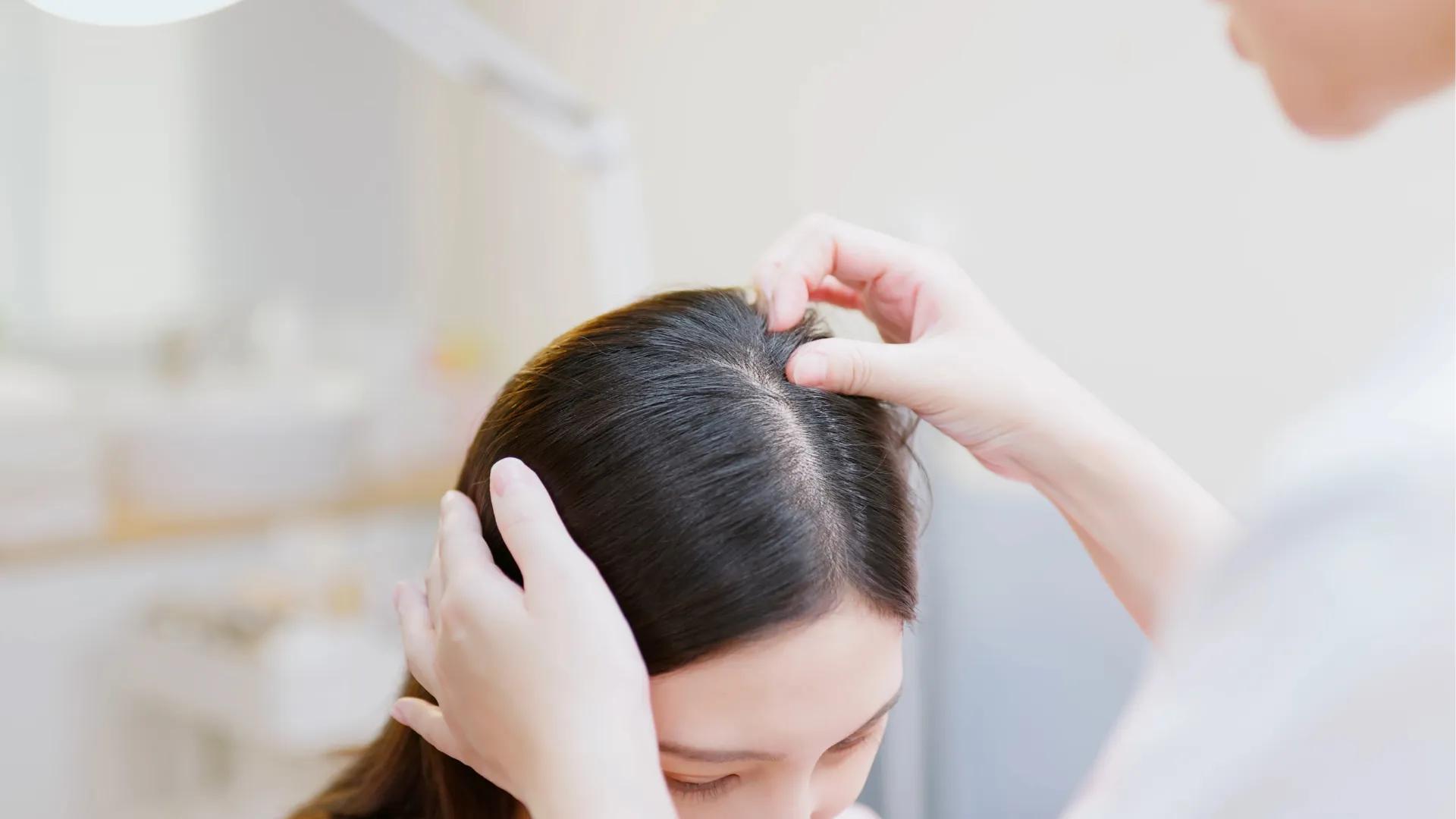 Title How to Determine If You Have a Sensitive Scalp