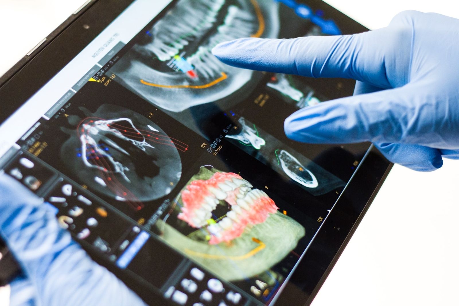 Dentist analyzing radiography