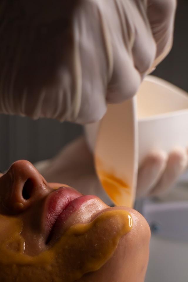 A close-up of warm amber honey being poured across a person’s cheek and jaw during a facial treatment.