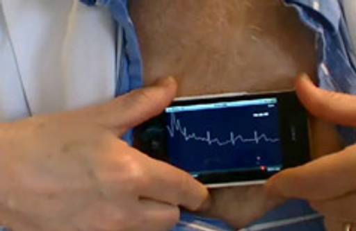 iPhone ECG