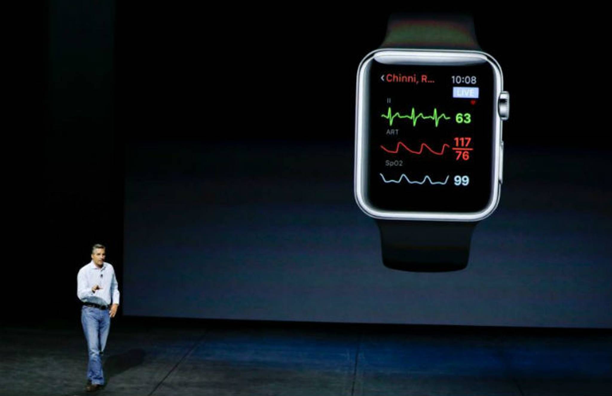 Pregnancy scans are coming to the Apple watch