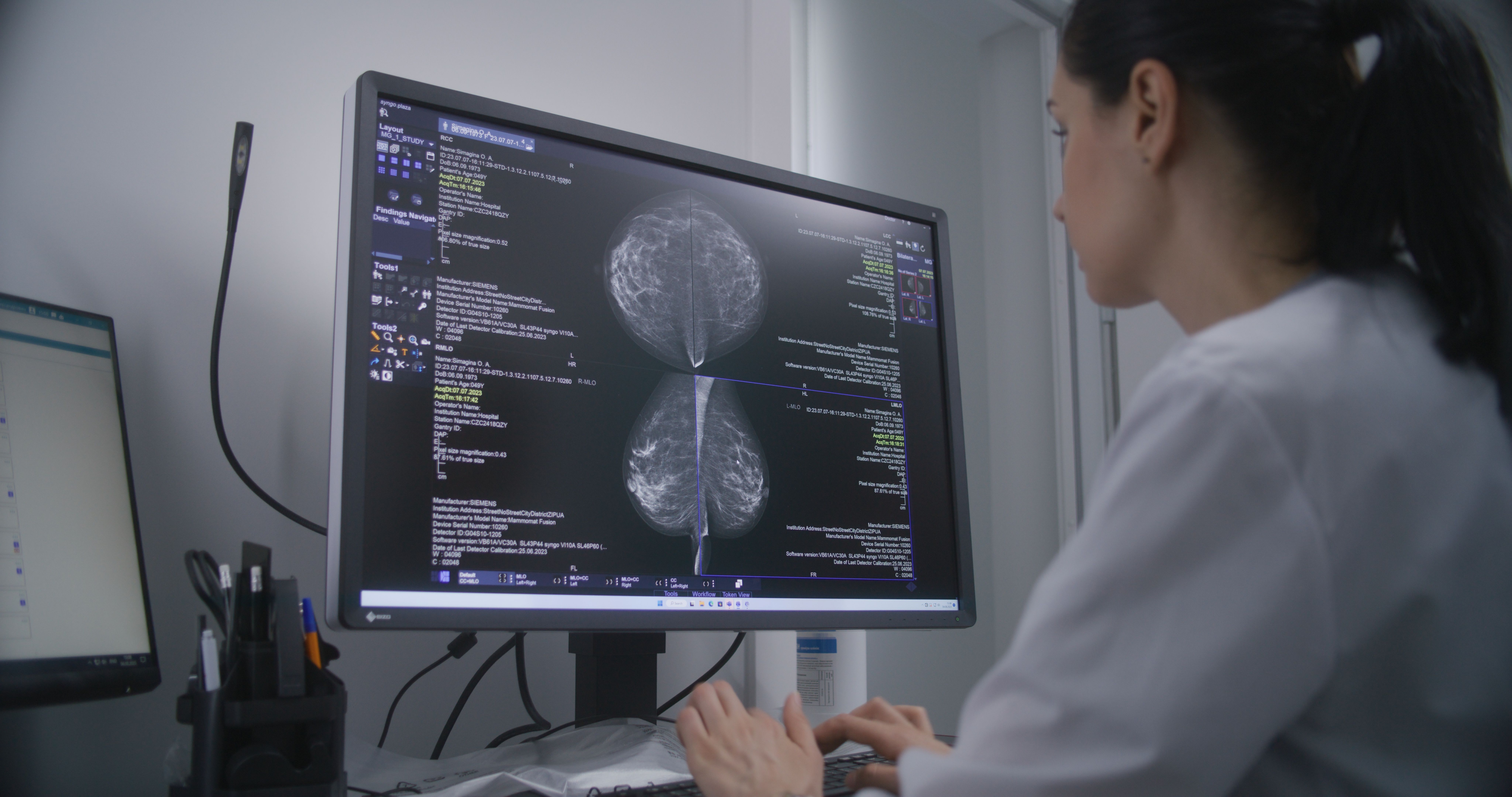 A radiologist examines mammogram scans on a diagnostic workstation screen
