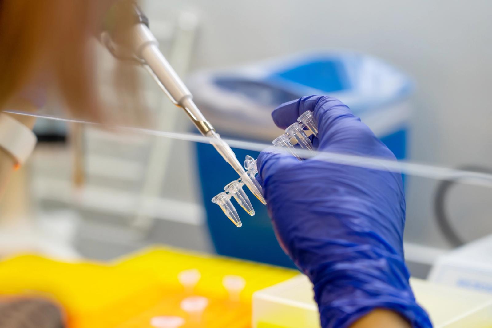 A scientist pipetting a sample into a vial for DNA testing