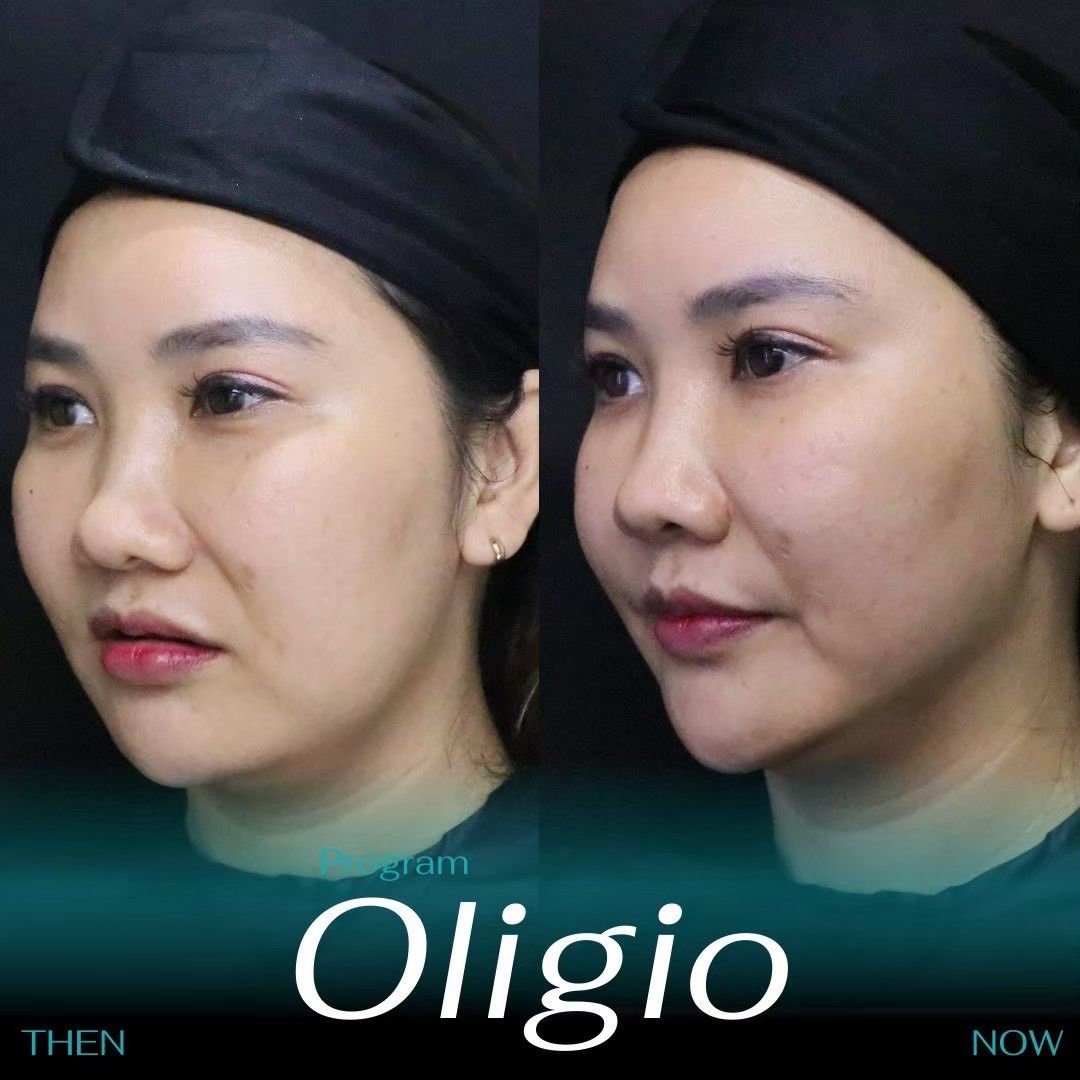Oligio 12