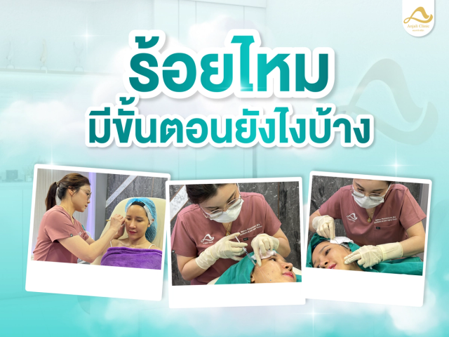 ร้อยไหม มีขั้นตอนยังไงบ้าง