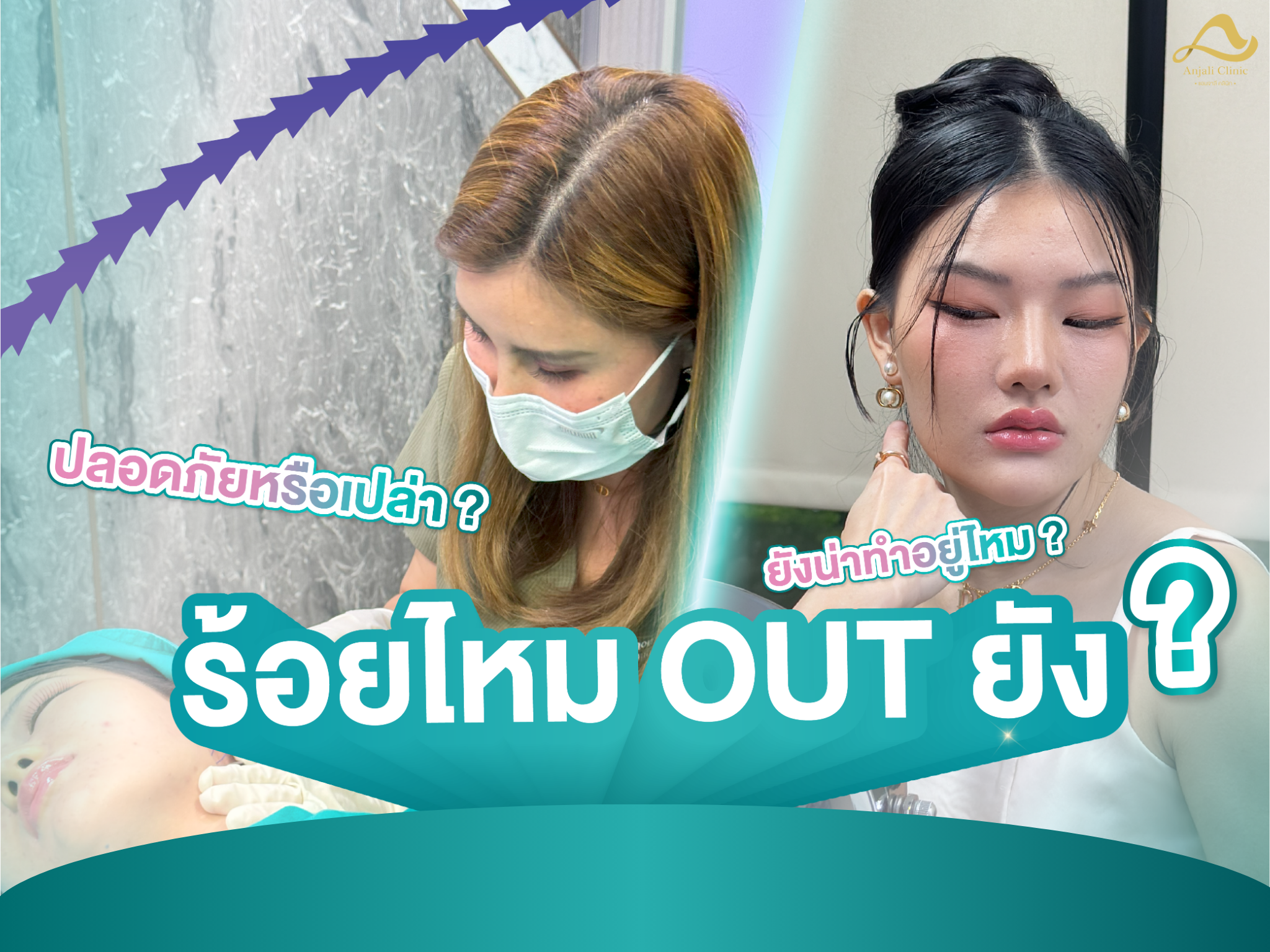 ร้อยไหม OUT หรือยัง ยังน่าทำอยู่ไหม ปลอดภัยหรือเปล่า ?