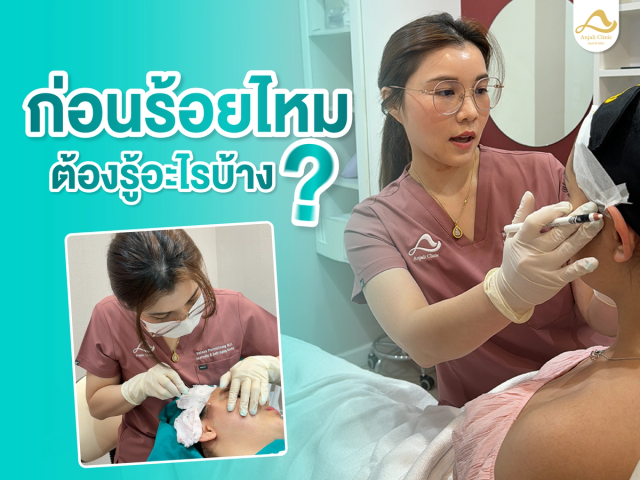 สิ่งที่ต้องรู้ ก่อนร้อยไหม