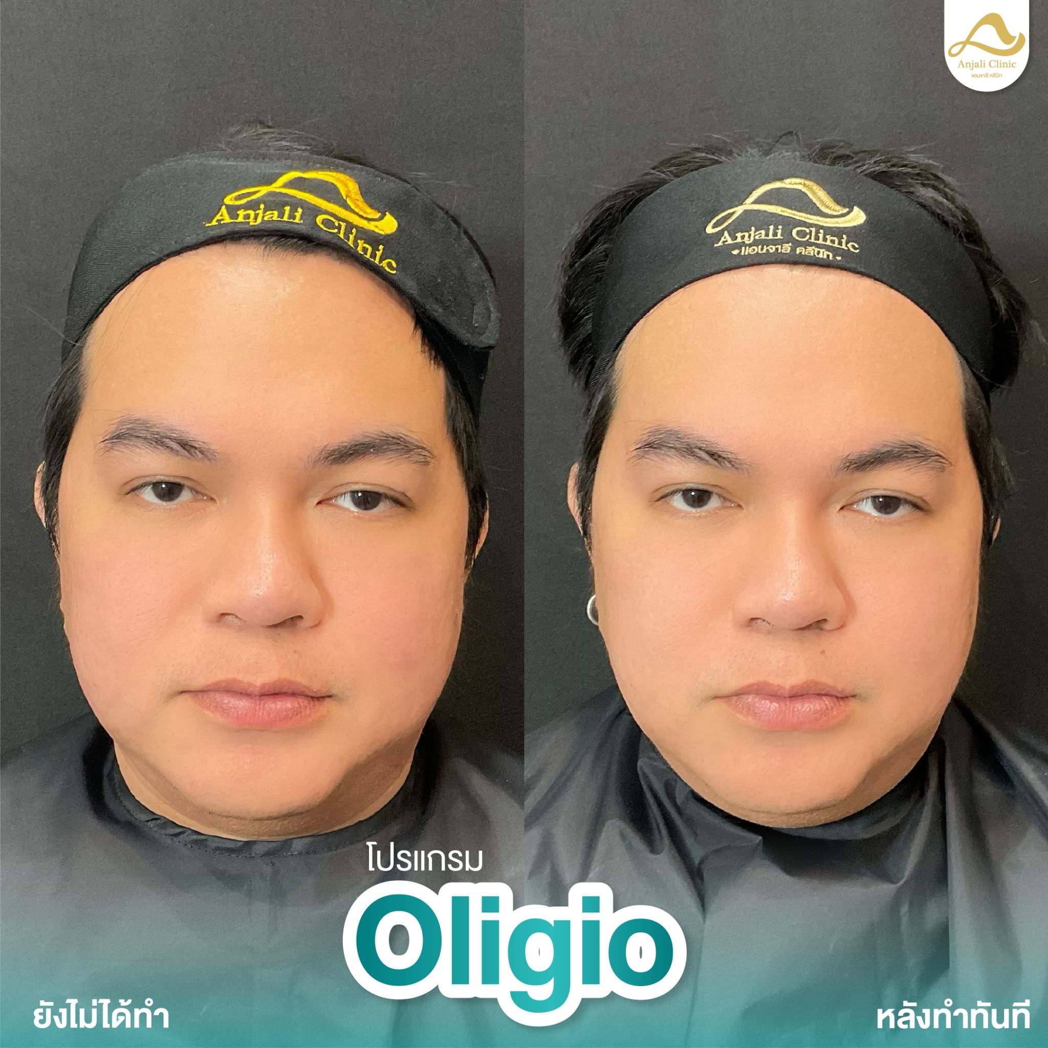 Oligio 7