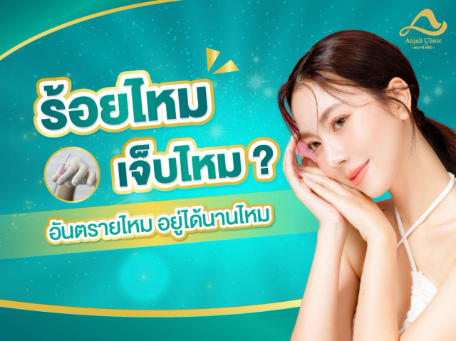 ร้อยไหมเจ็บไหม ไขข้อสงสัยสำหรับสาว ๆ ที่ต้องการผิวหน้ากระชับได้โดยไม่ต้องศัลยกรรม