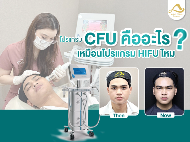 CFU คืออะไร เหมือน HIFU ไหม ?