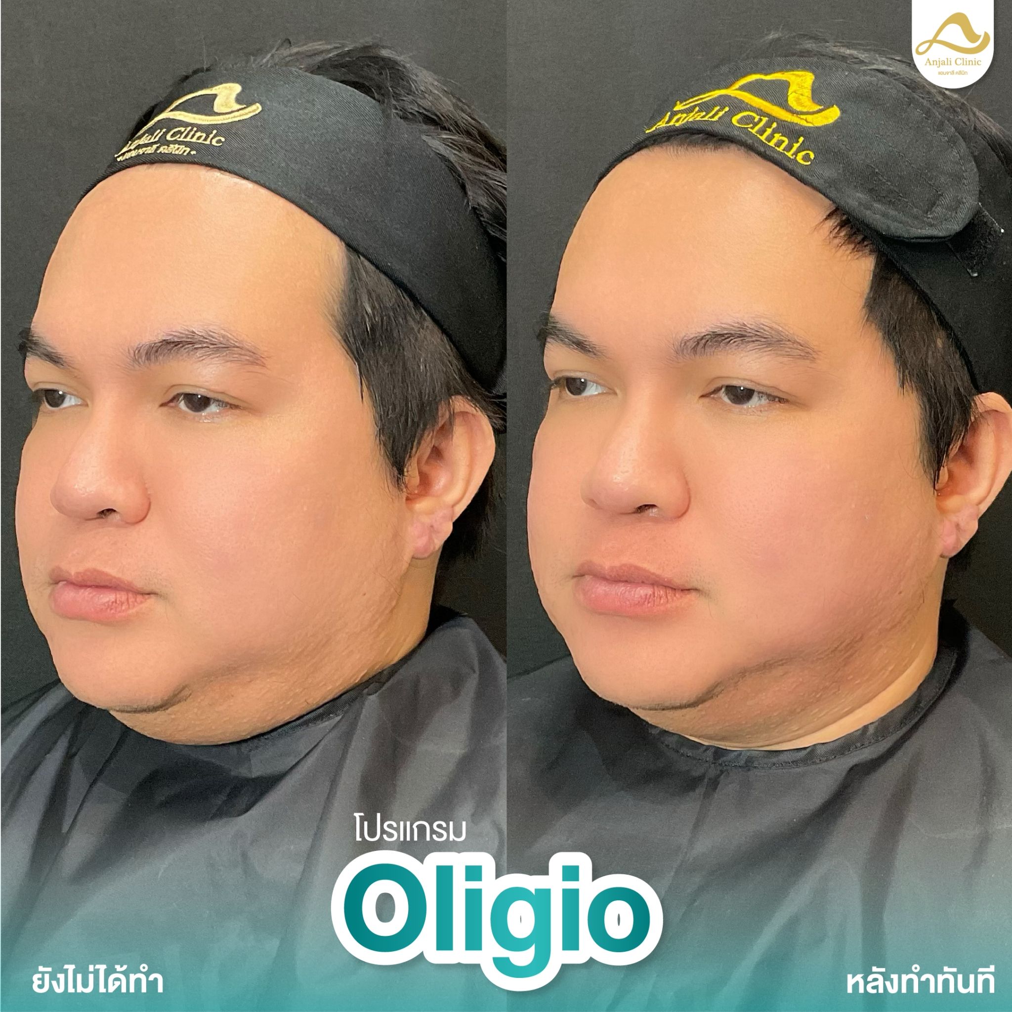 Oligio 8