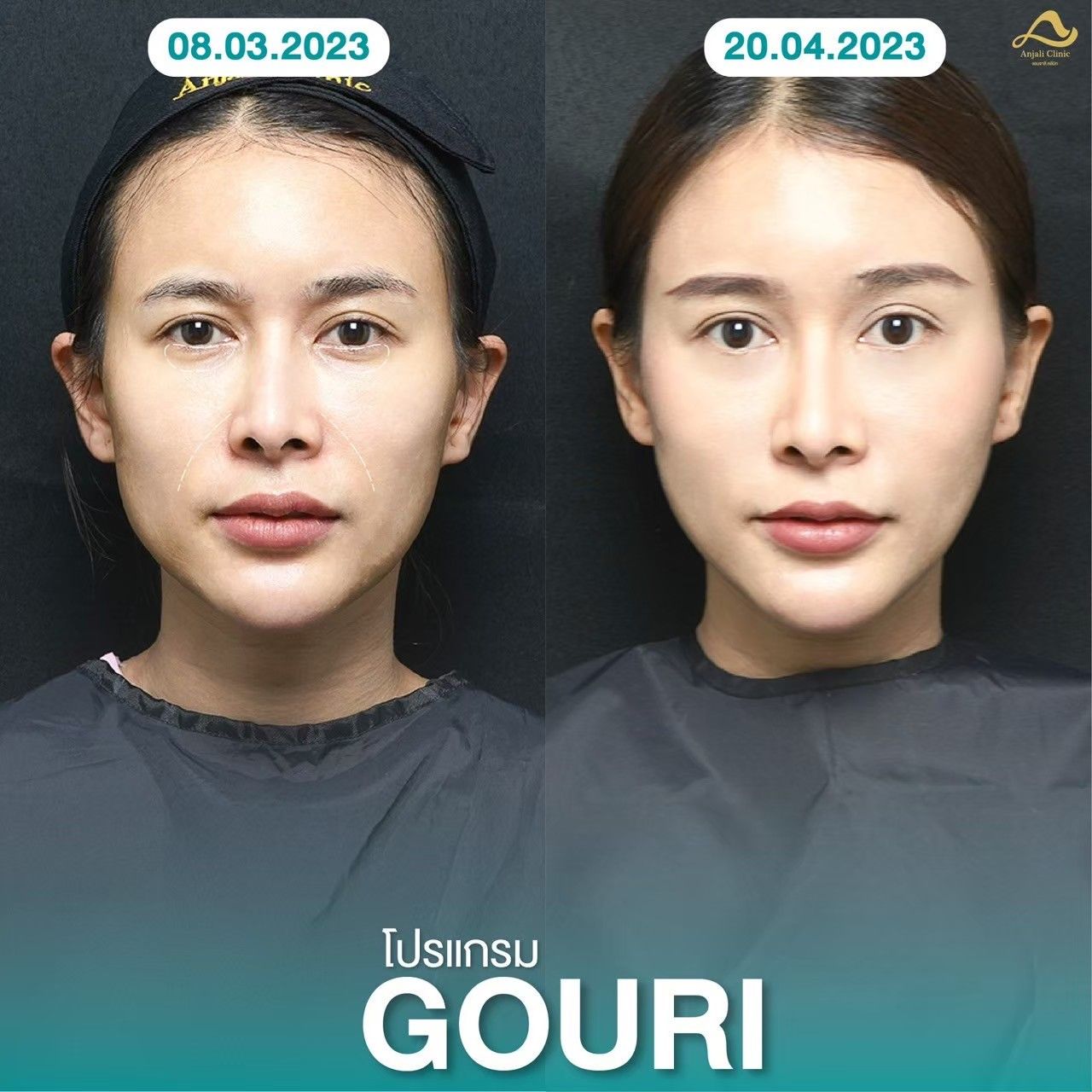 Gouri 2