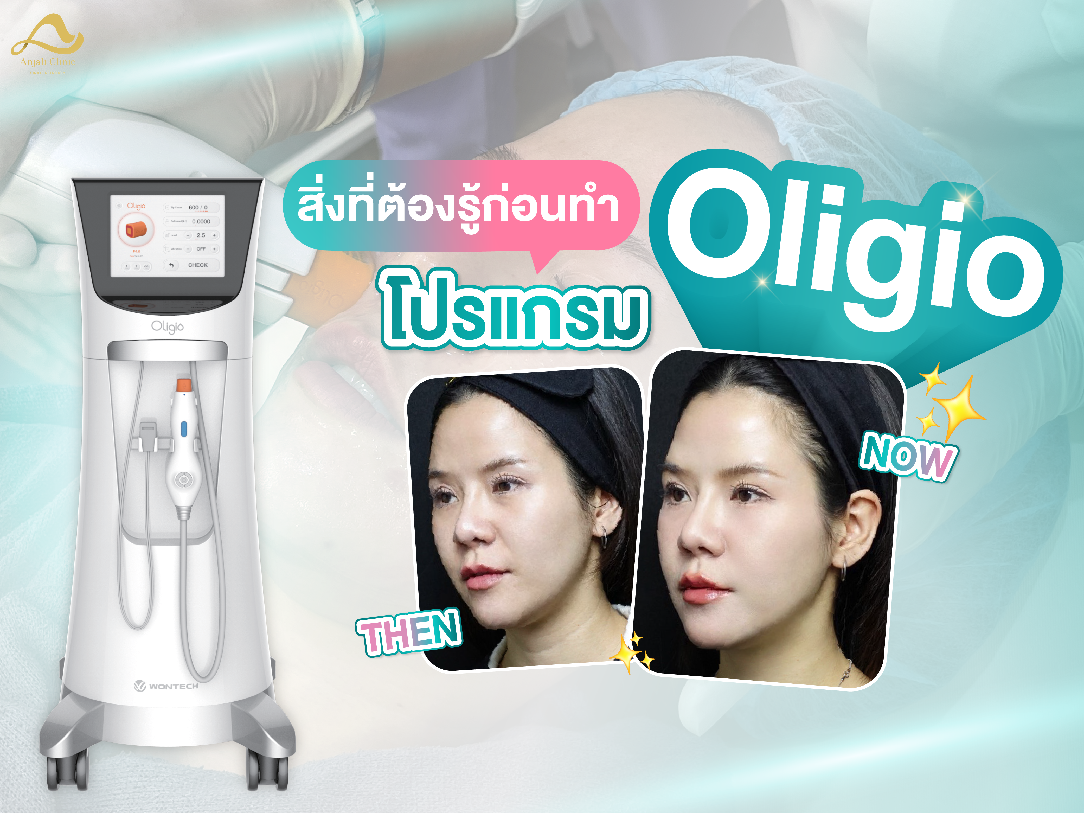 สิ่งที่ต้องรู้ก่อนทำ Oligio