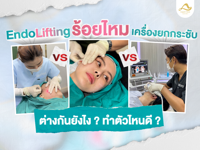 Endolifting ต่างจากการร้อยไหม หรือเครื่องยกกระชับยังไง?