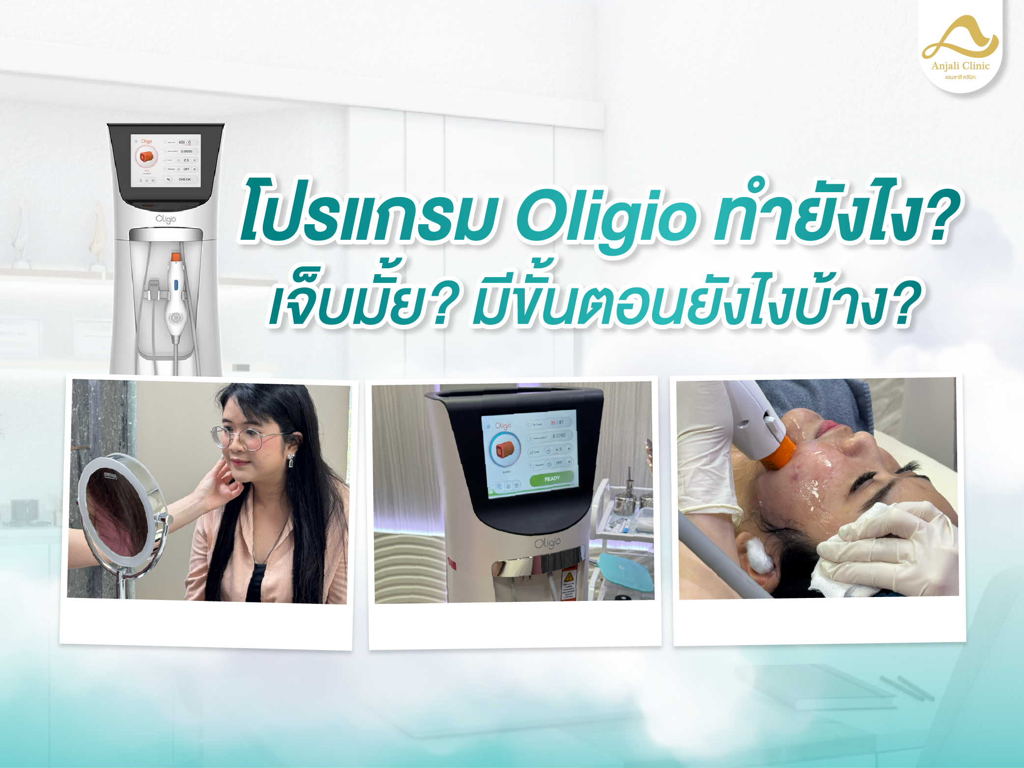 Oligio ทำยังไง? เจ็บมั้ย? มีขั้นตอนยังไงบ้าง? เล่าให้ฟังหมดแบบ Step by Step