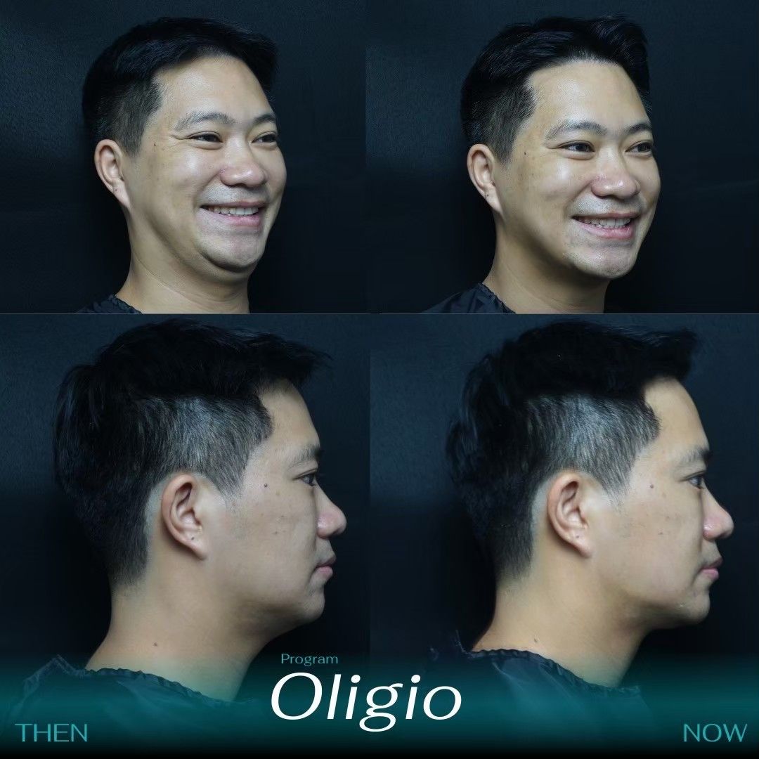 Oligio 14