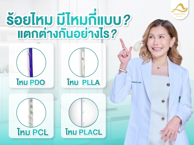 ร้อยไหม มีไหมกี่แบบ? แตกต่างกันอย่างไร ?
