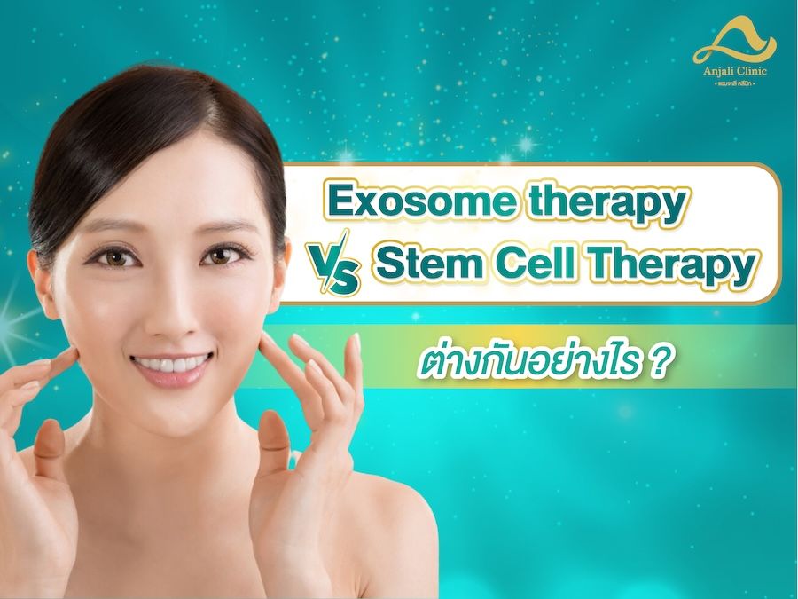 exosome therapy VS Stem Cell Therapy ต่างกันอย่างไร? - คลินิคแอนจาลี
