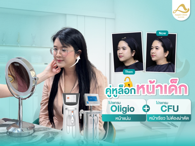 โปรแกรม Oligio + CFU คู่หูล็อกหน้าเด็ก
