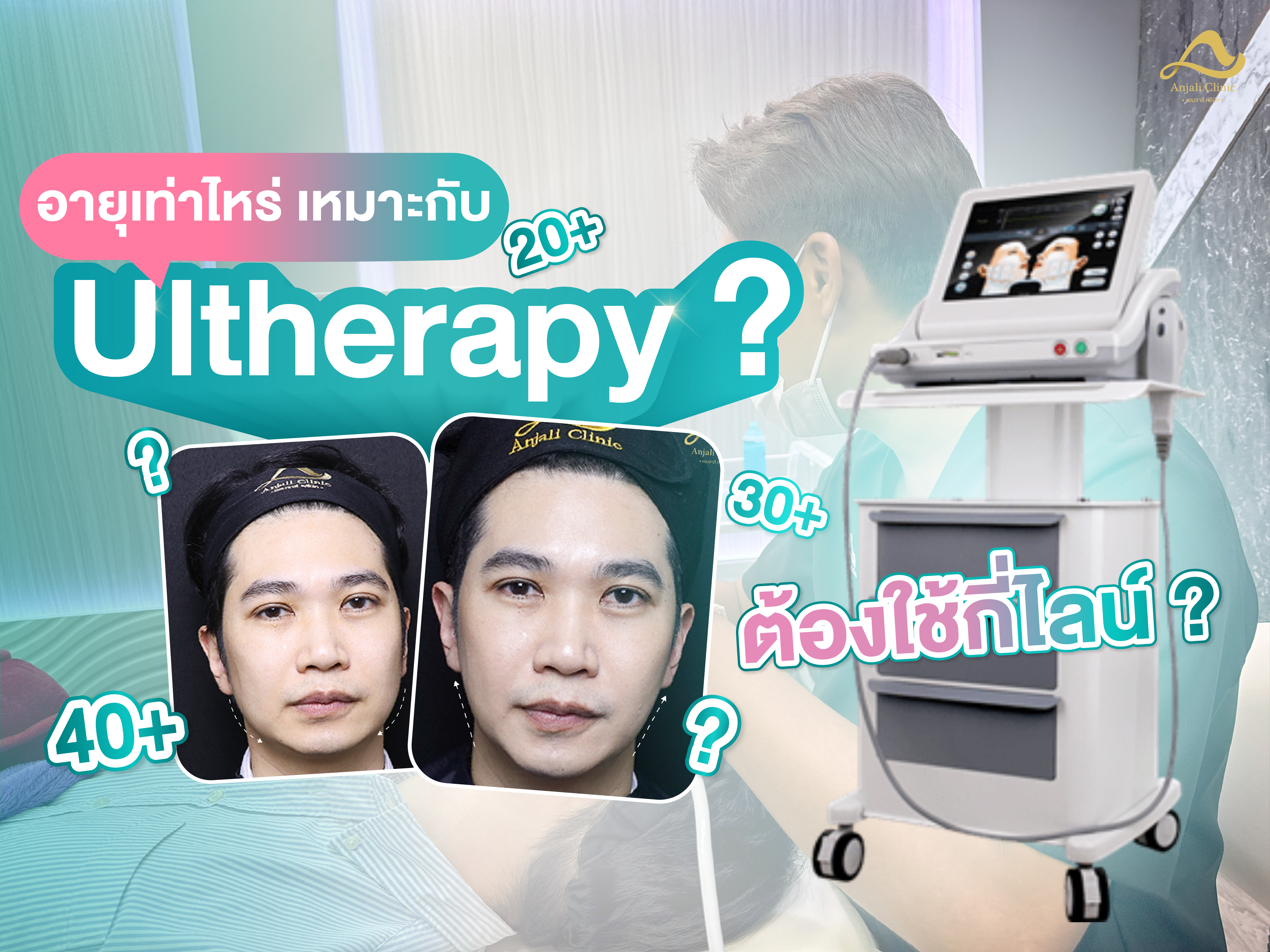 อายุเท่าไรถึงเหมาะกับการทำUlthera ? แล้วต้องทำกี่ไลน์ ?
