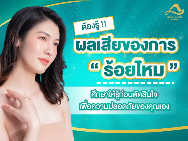 ร้อยไหม ผลเสีย ศึกษาให้รู้ก่อนตัดสินใจ เพื่อความปลอดภัยของคุณเอง 