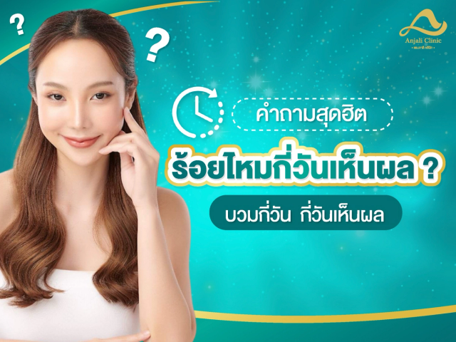 ร้อยไหมกี่วันเห็นผล หลังเข้ารับบริการต้องดูแลตัวเองอย่างไร