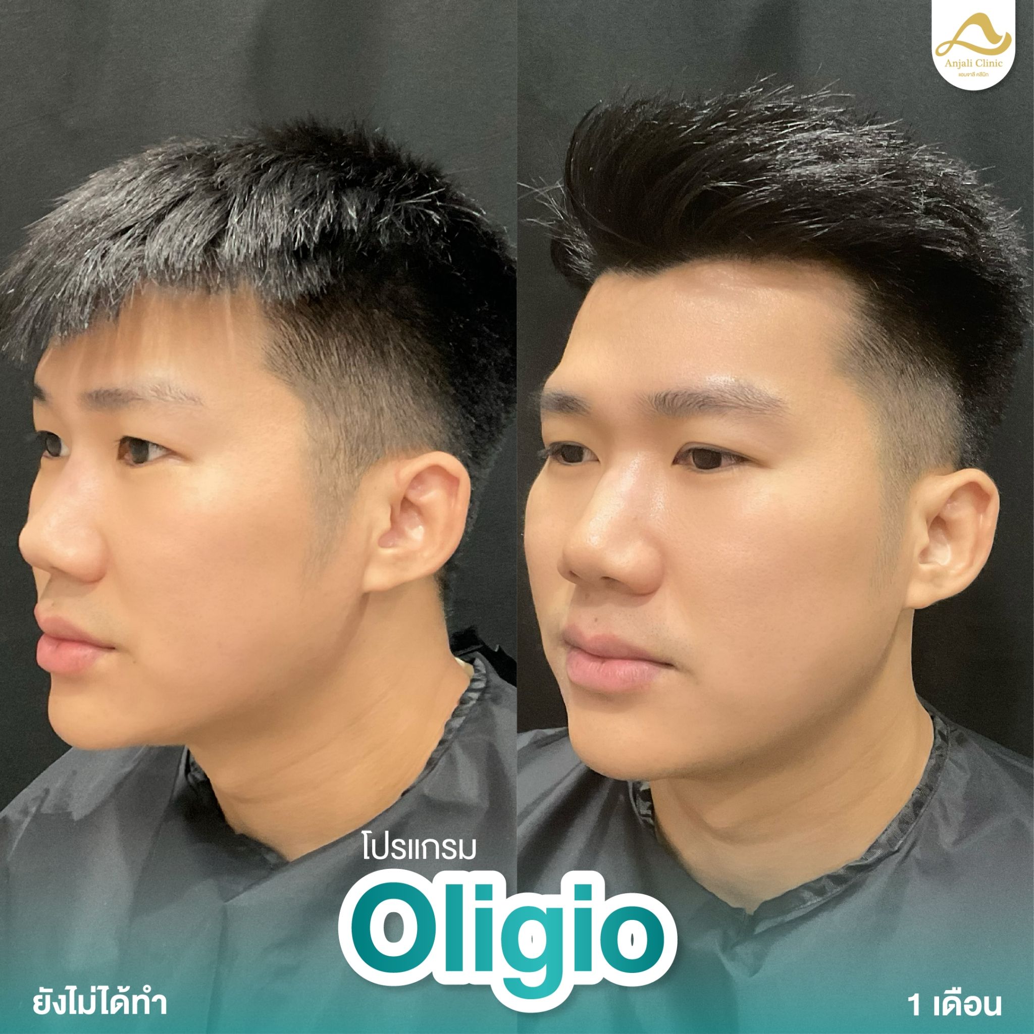Oligio 6