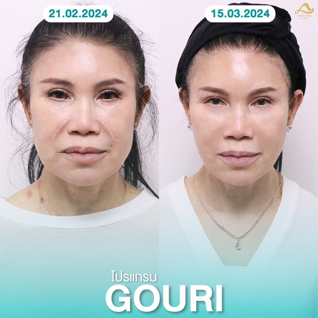 Gouri 1