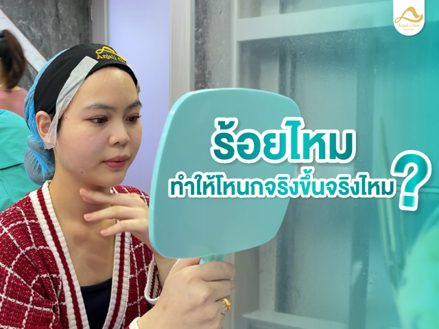 ร้อยไหมแล้วโหนกแก้มใหญ่ จริงไหม ? 