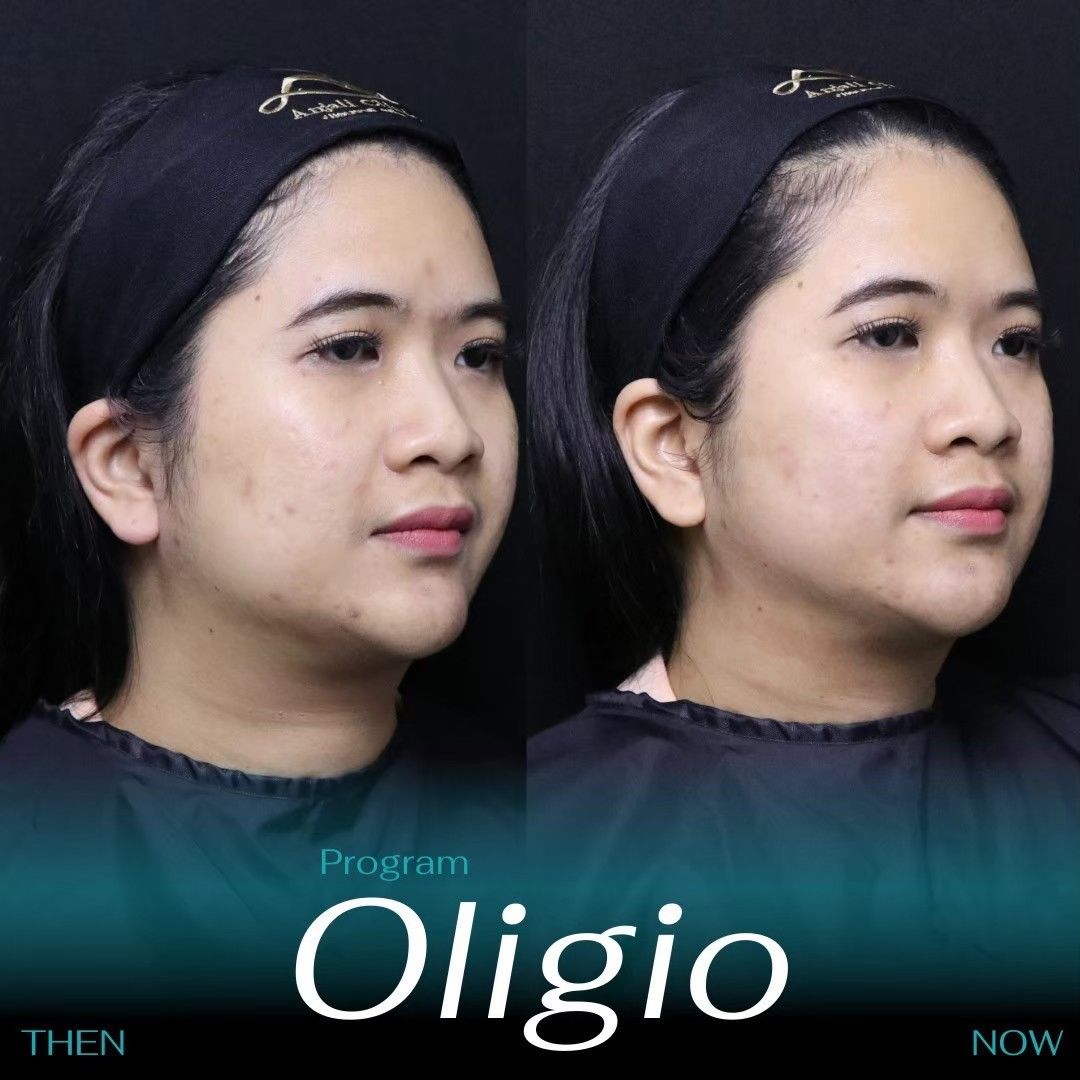 Oligio 11