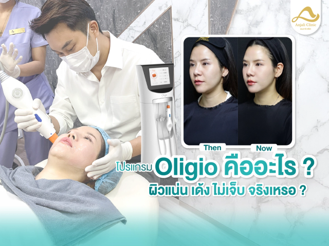 Oligio โปรแกรมผิวแน่น เด้ง ตึงแบบไม่เจ็บ! ที่วัยรุ่นนิยมทำ คืออะไร?