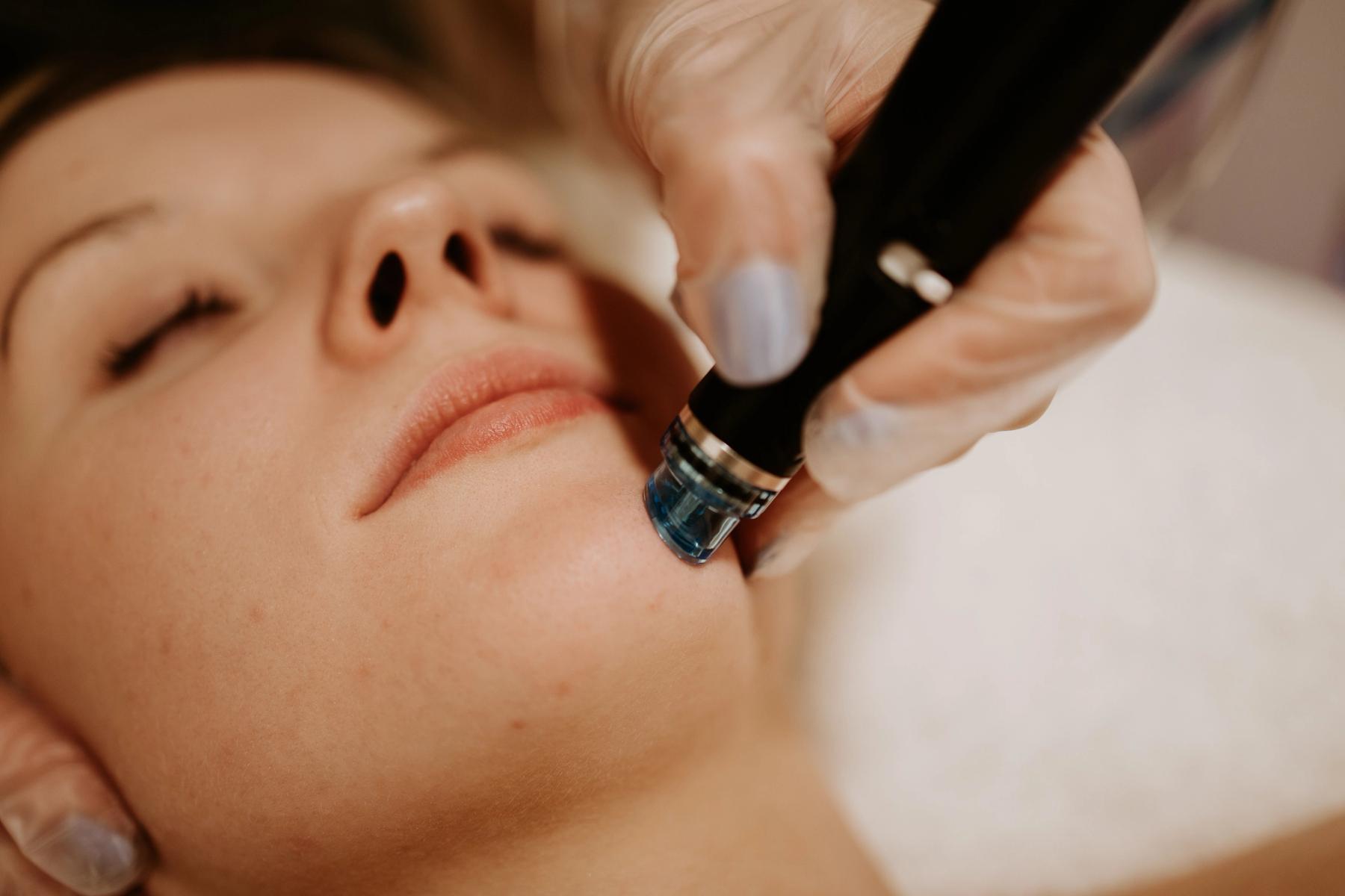HydraFacial