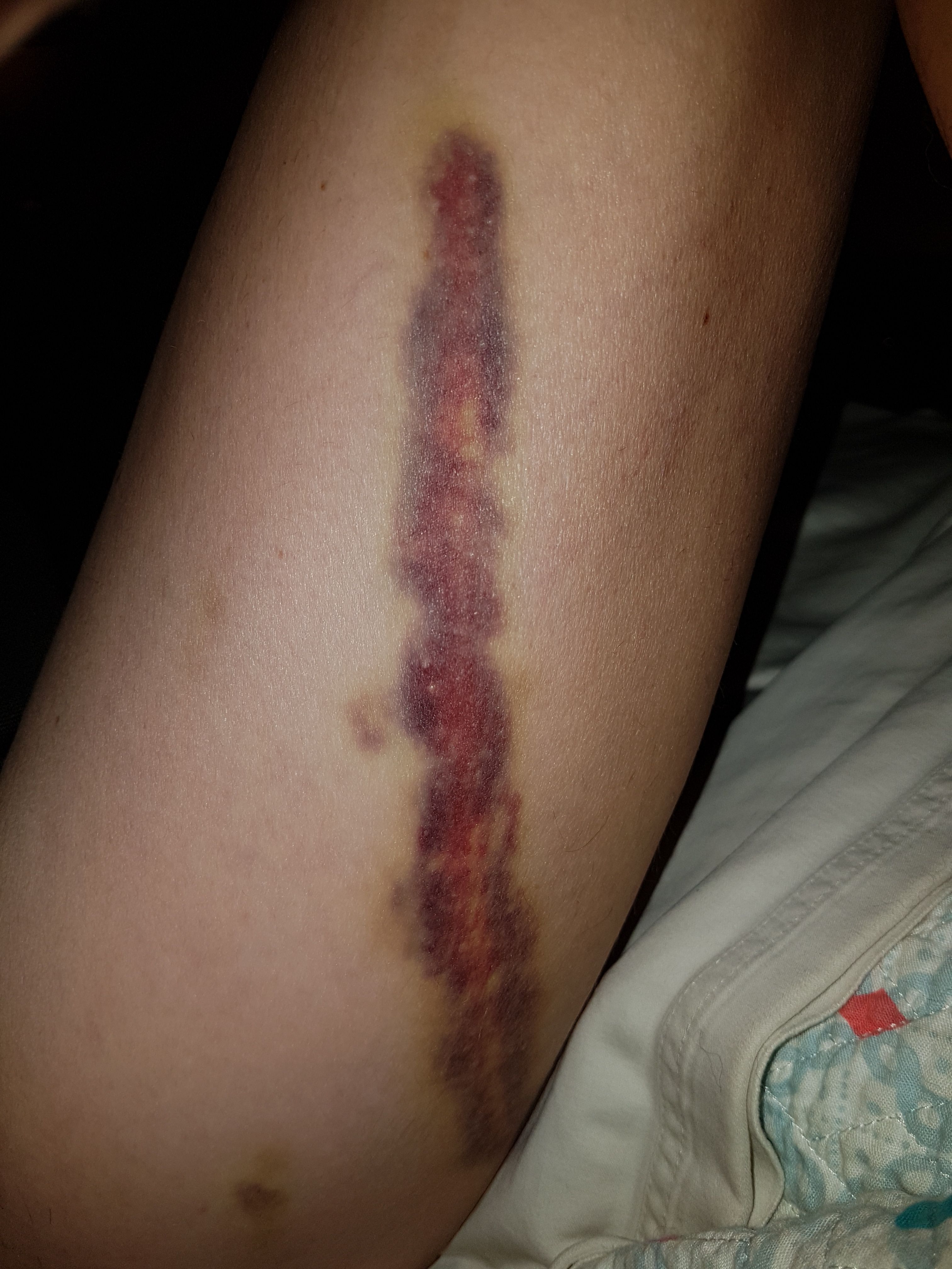 Does your dog jump up on guests?