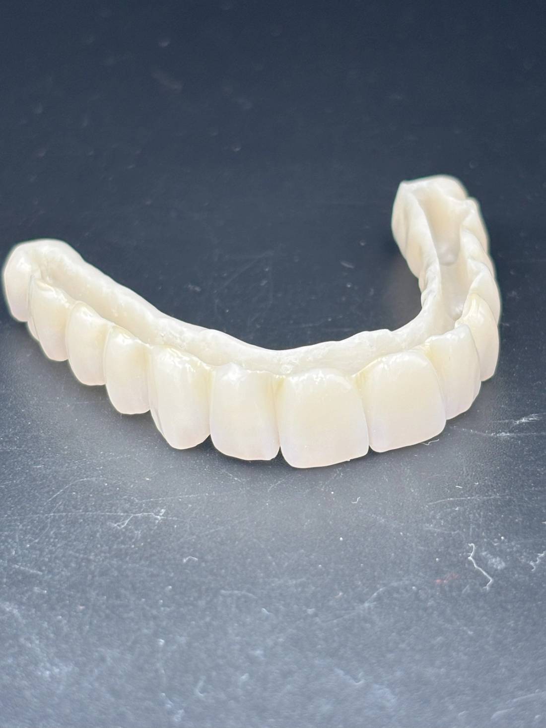 Prepped All on 6 - Zirconia