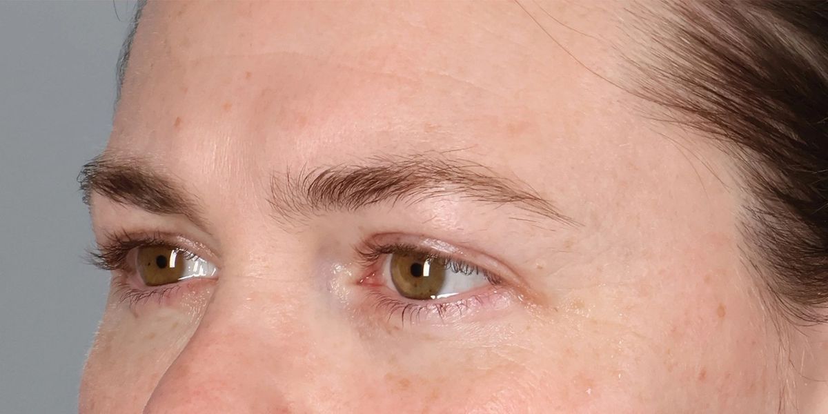 Case 2006 — Oblique after