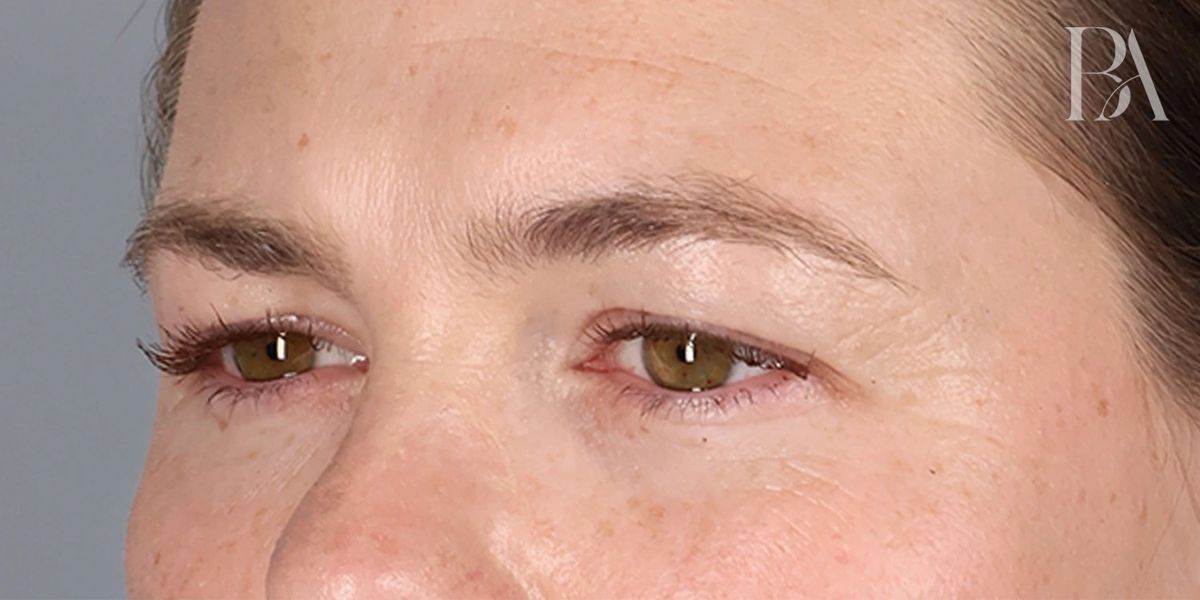 Case 2006 — Oblique before
