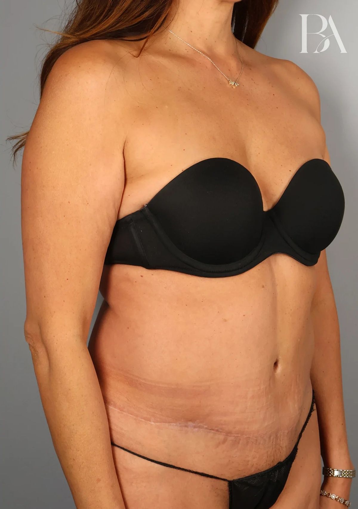 Case 5002 — Oblique after