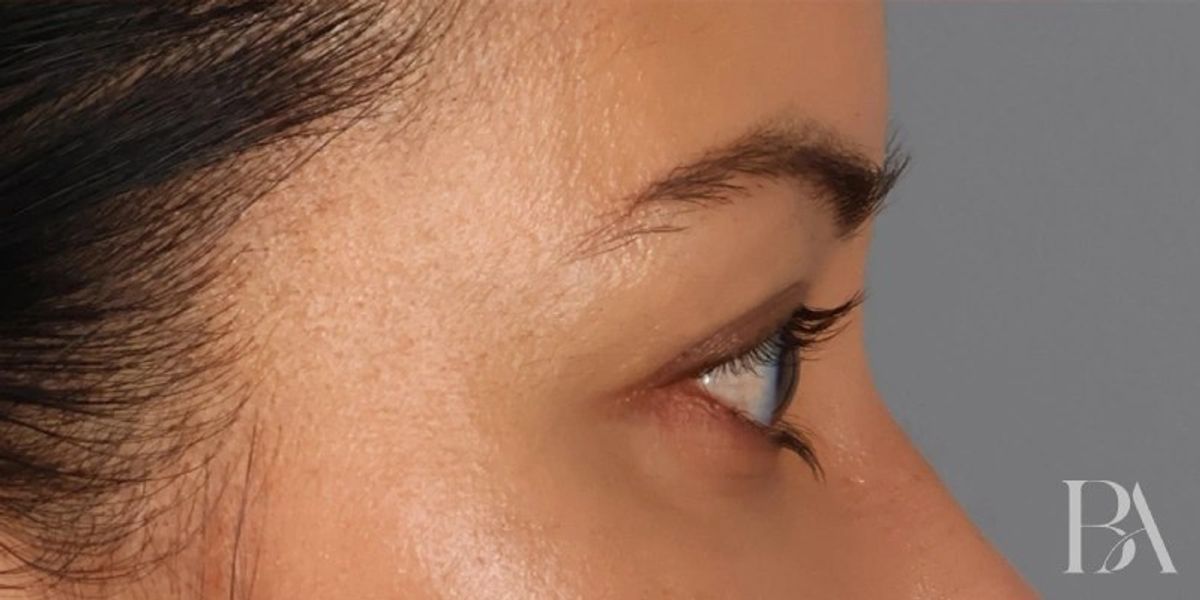 Case 2001 — Oblique after