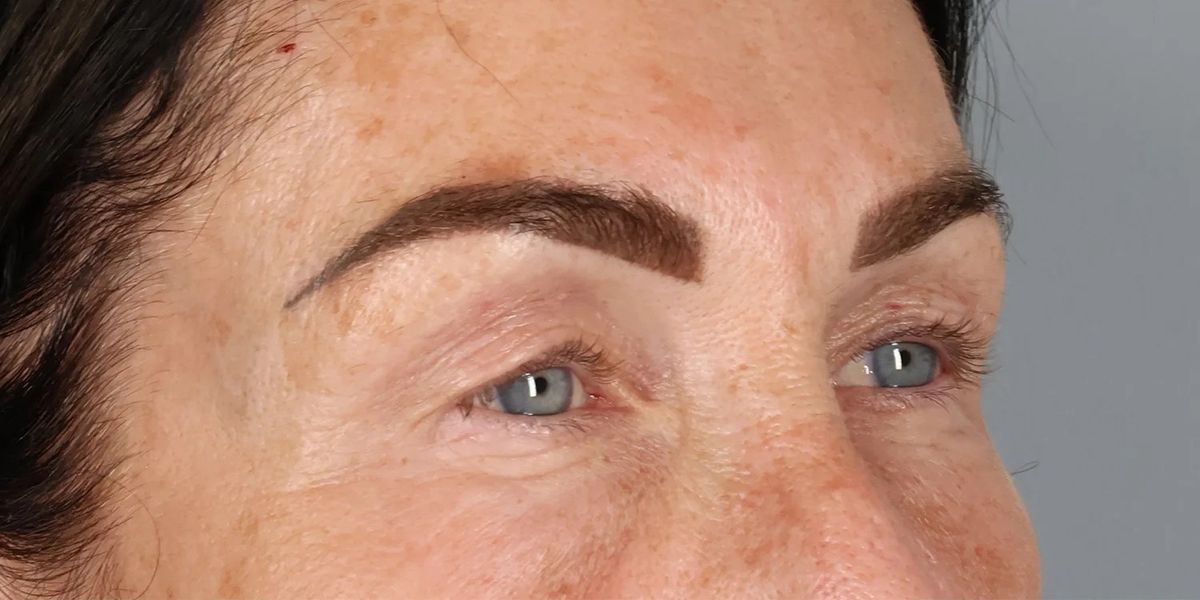 Case 2003 — Oblique before