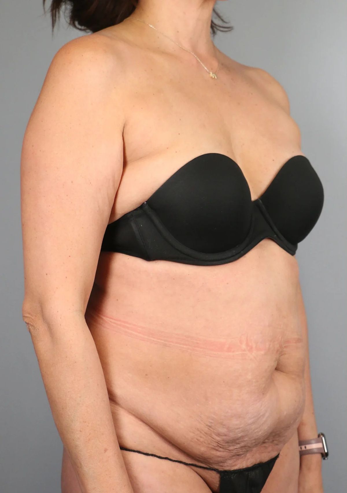 Case 5002 — Oblique before