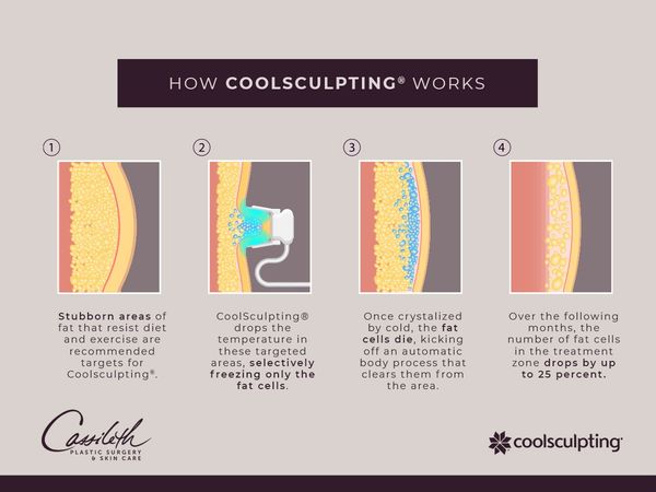 What Areas Can CoolSculpting® Address?