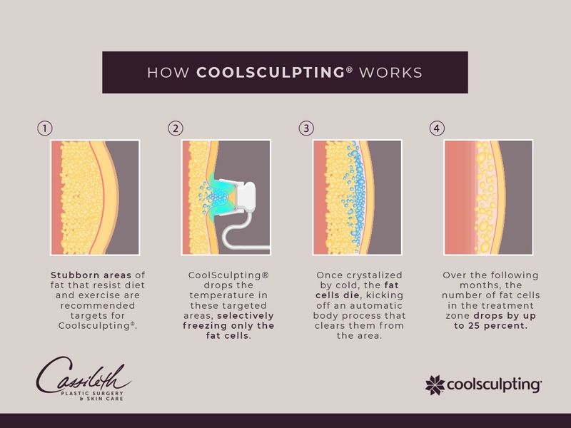 What Areas Can CoolSculpting® Address?