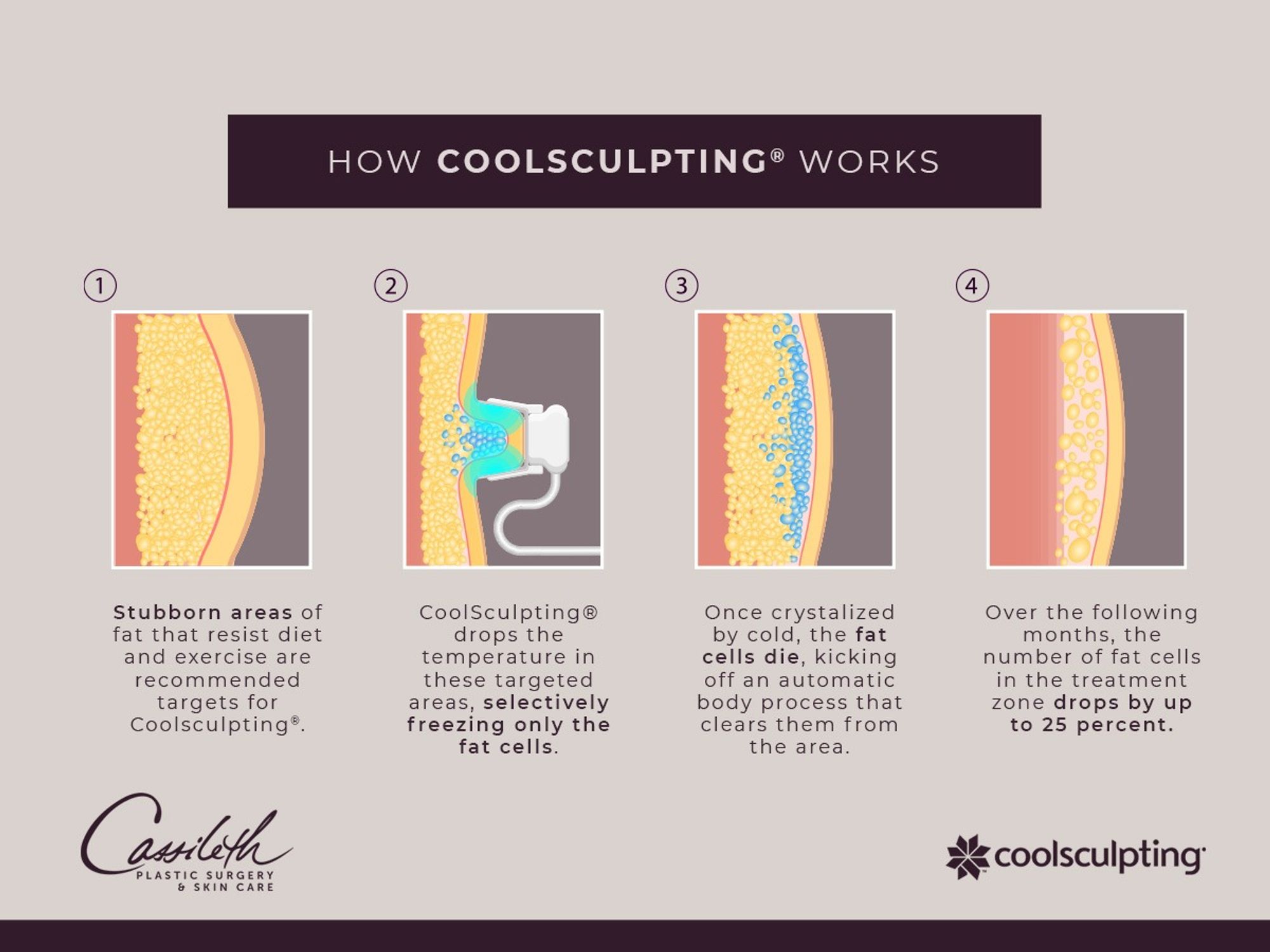 What Areas Can CoolSculpting® Address?