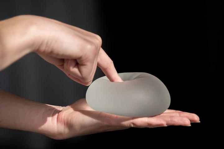 Benefits And Risks of Explant Surgery to Remove Breast Implants