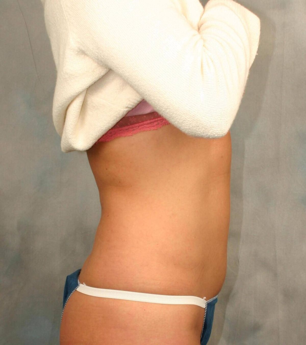 Case 1672 — Oblique after