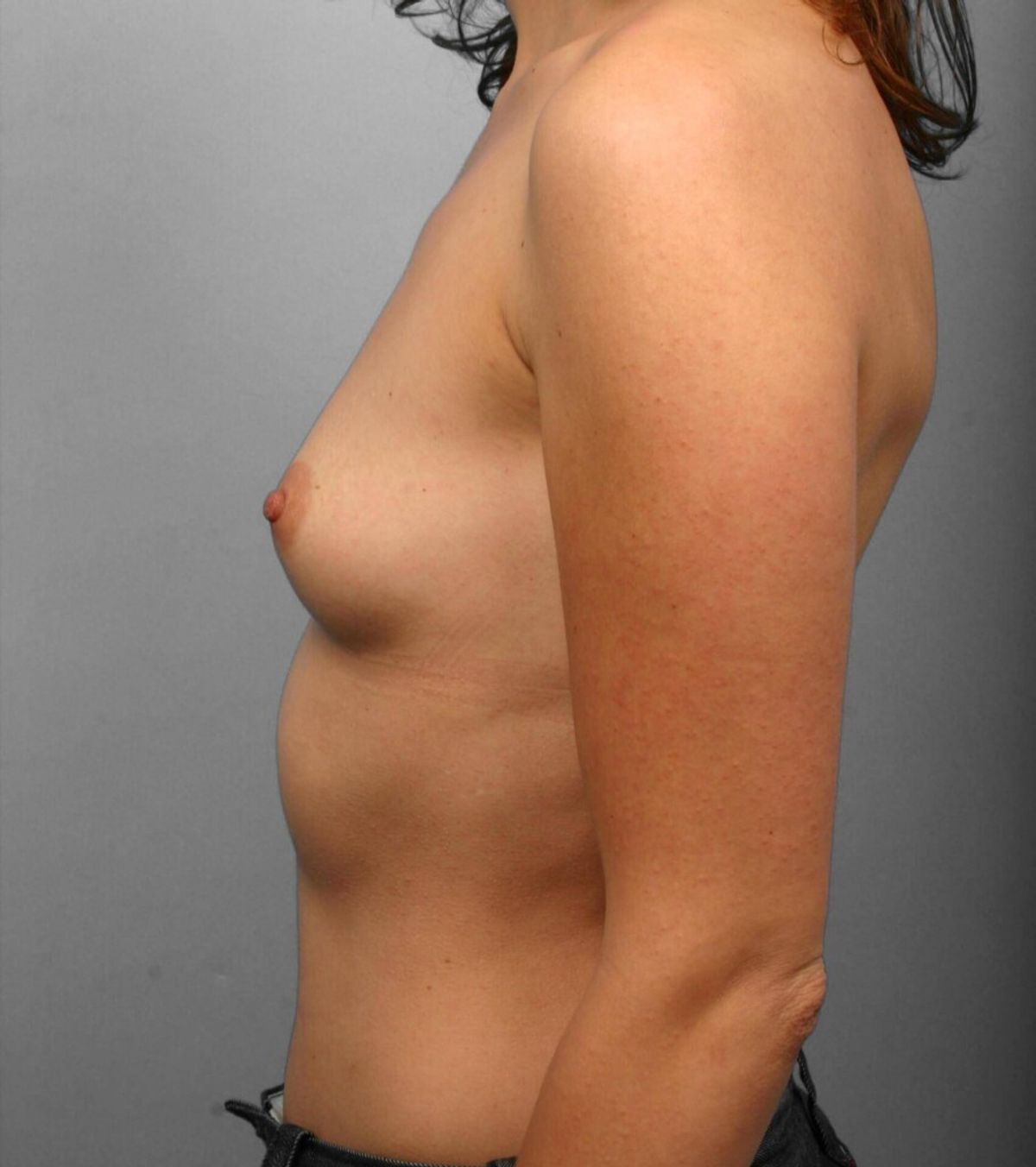 Case 1293 — Oblique before